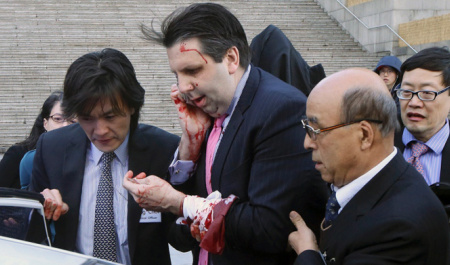 Knife Attack Hospitalizes US Ambassador to South Korea